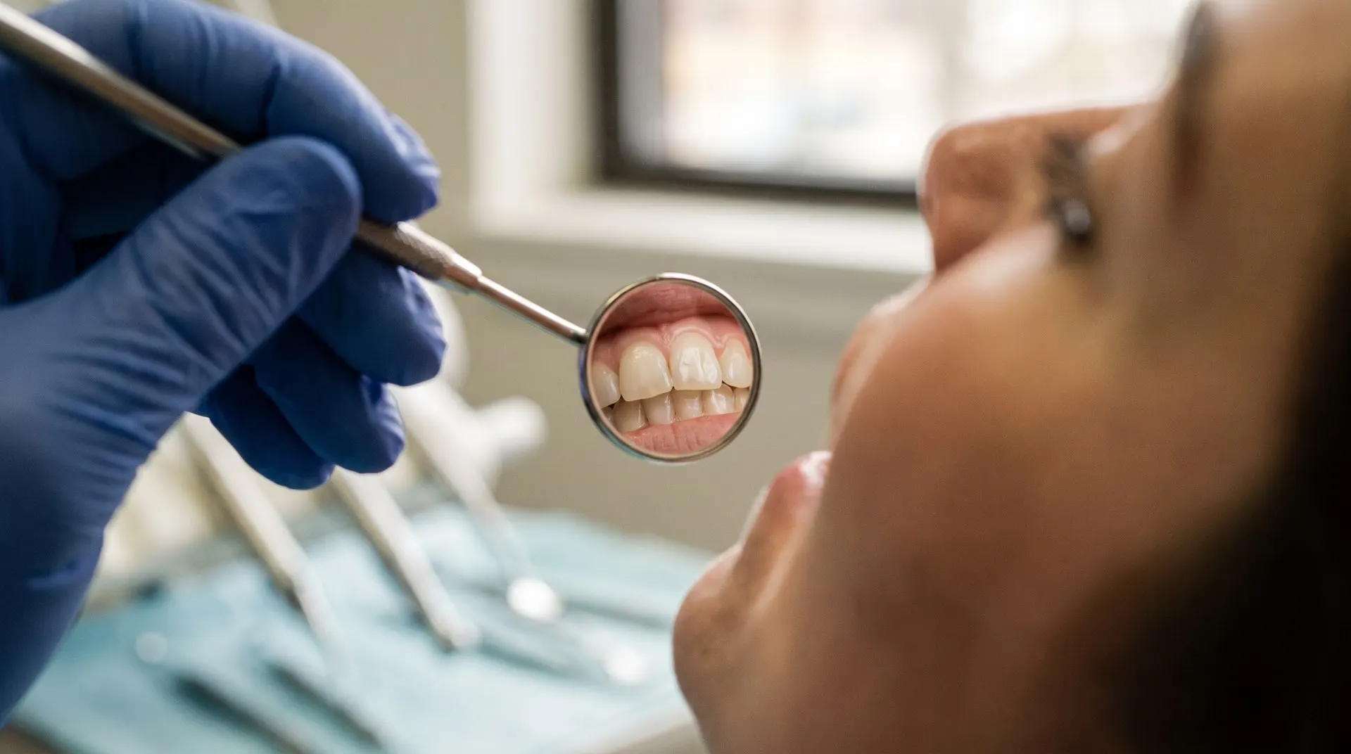 Dentist examining natural front teeth with a mirror before veneer planning