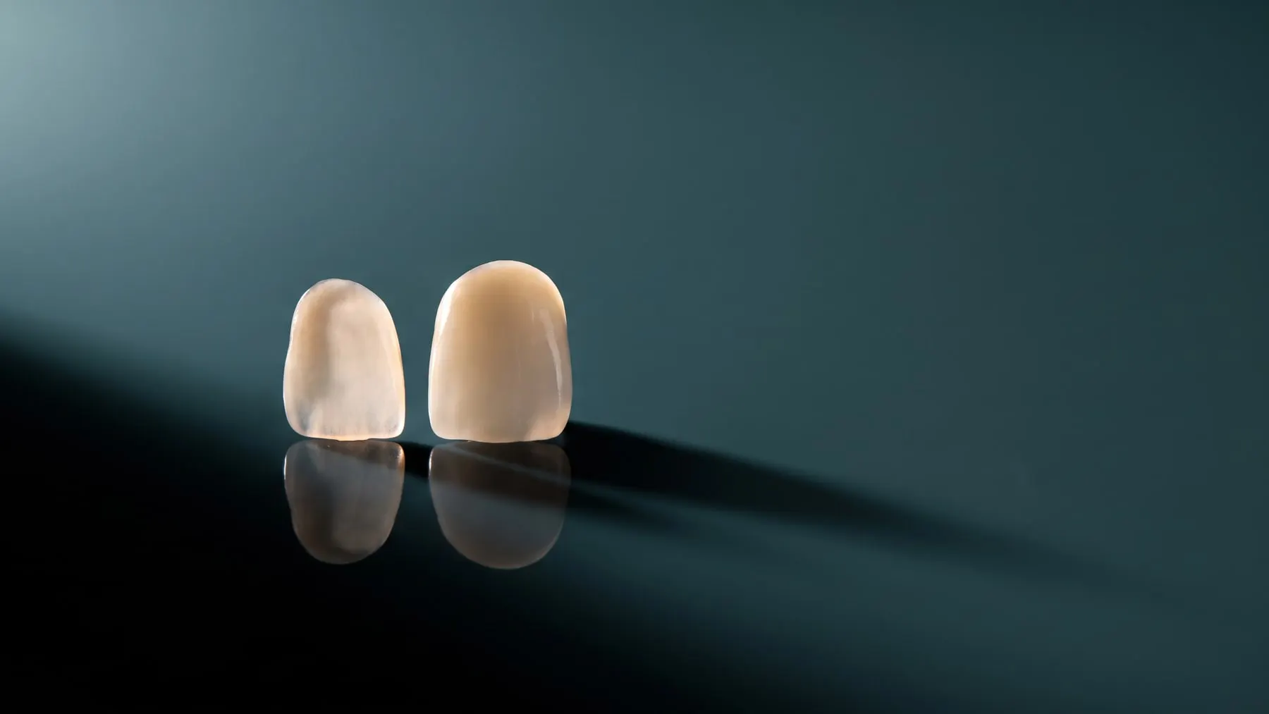 A porcelain veneer and a zirconia crown from the in-house lab